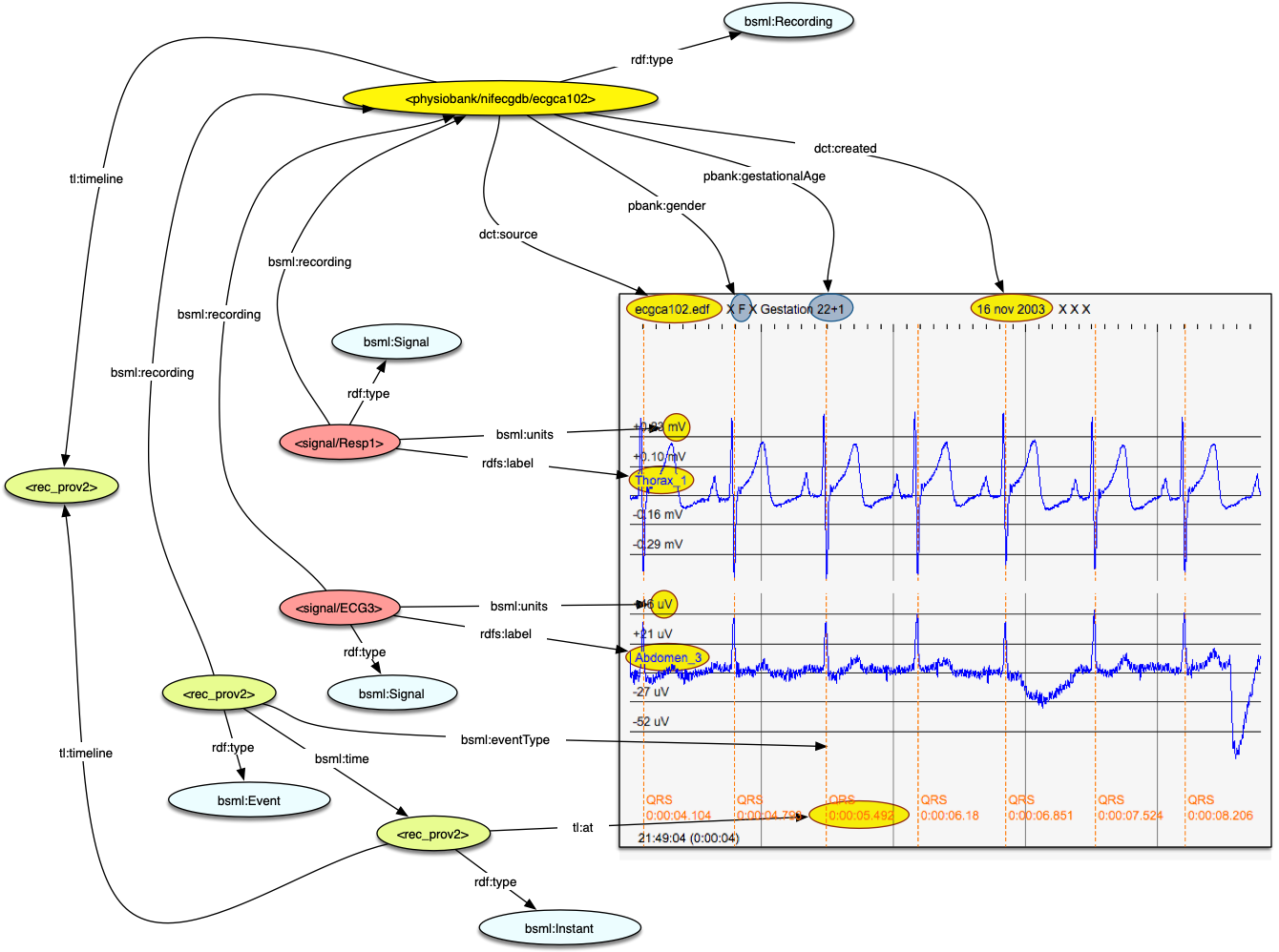 BioSignalML markup of an EDF+ file